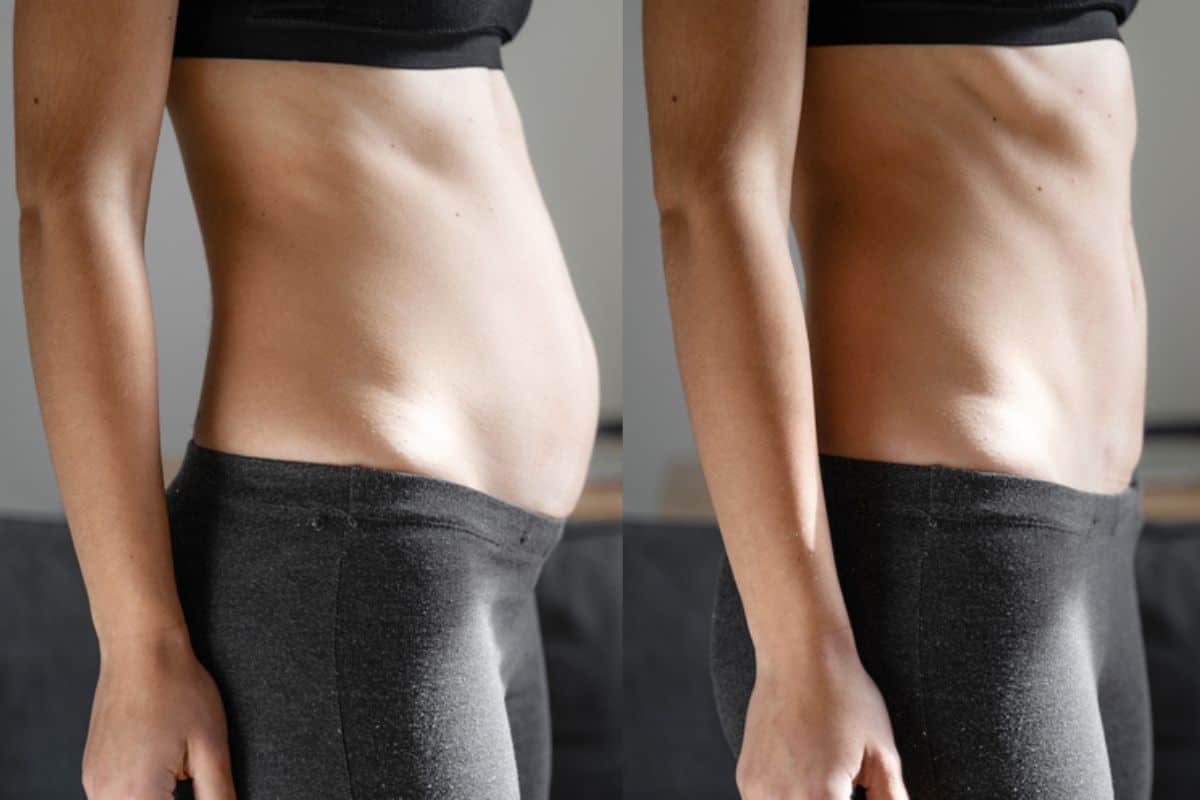 Post-Pregnancy: What Happens to Your Abdominal Muscles After Birth Hertford