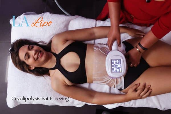 woman getting cryolipolysis Hertford