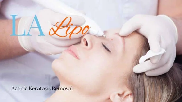 Woman receiving Actinic Keratosis Removal Treatment Hertford