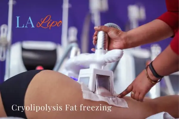 women getting fat freezing Hertford