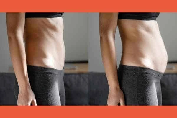 LA-EMS Body Sculpting results Hertford
