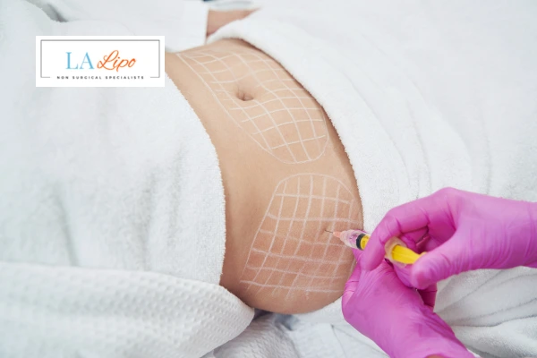 aqualyx fat dissolving injections Hertford