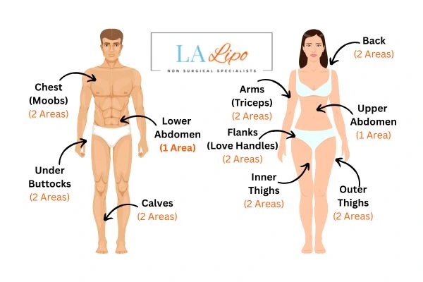 LA LIPO Cryolipolysis Areas Hertford