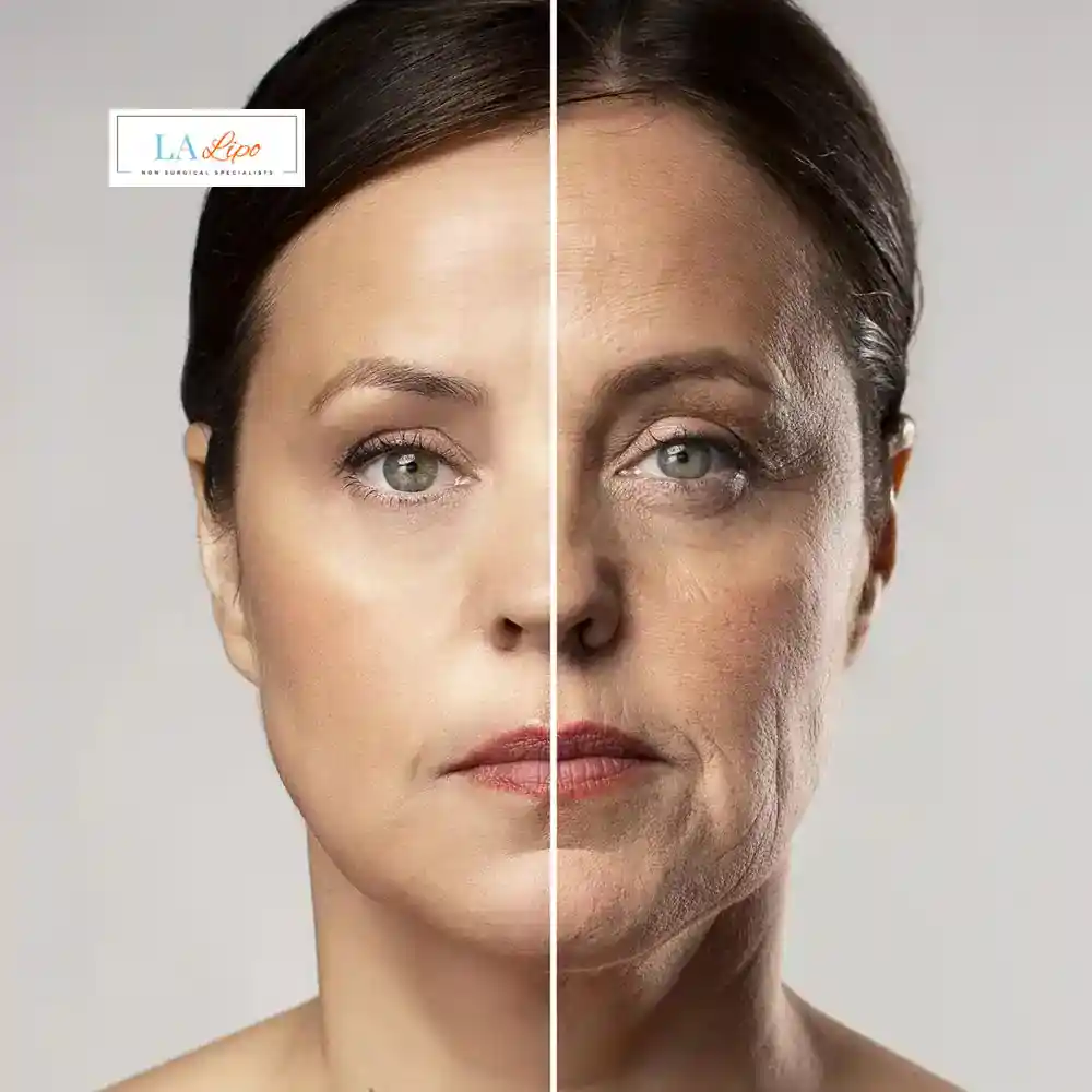 How Can You Tell If Non-Surgical Skin Tightening Is Right for You Hertford?
