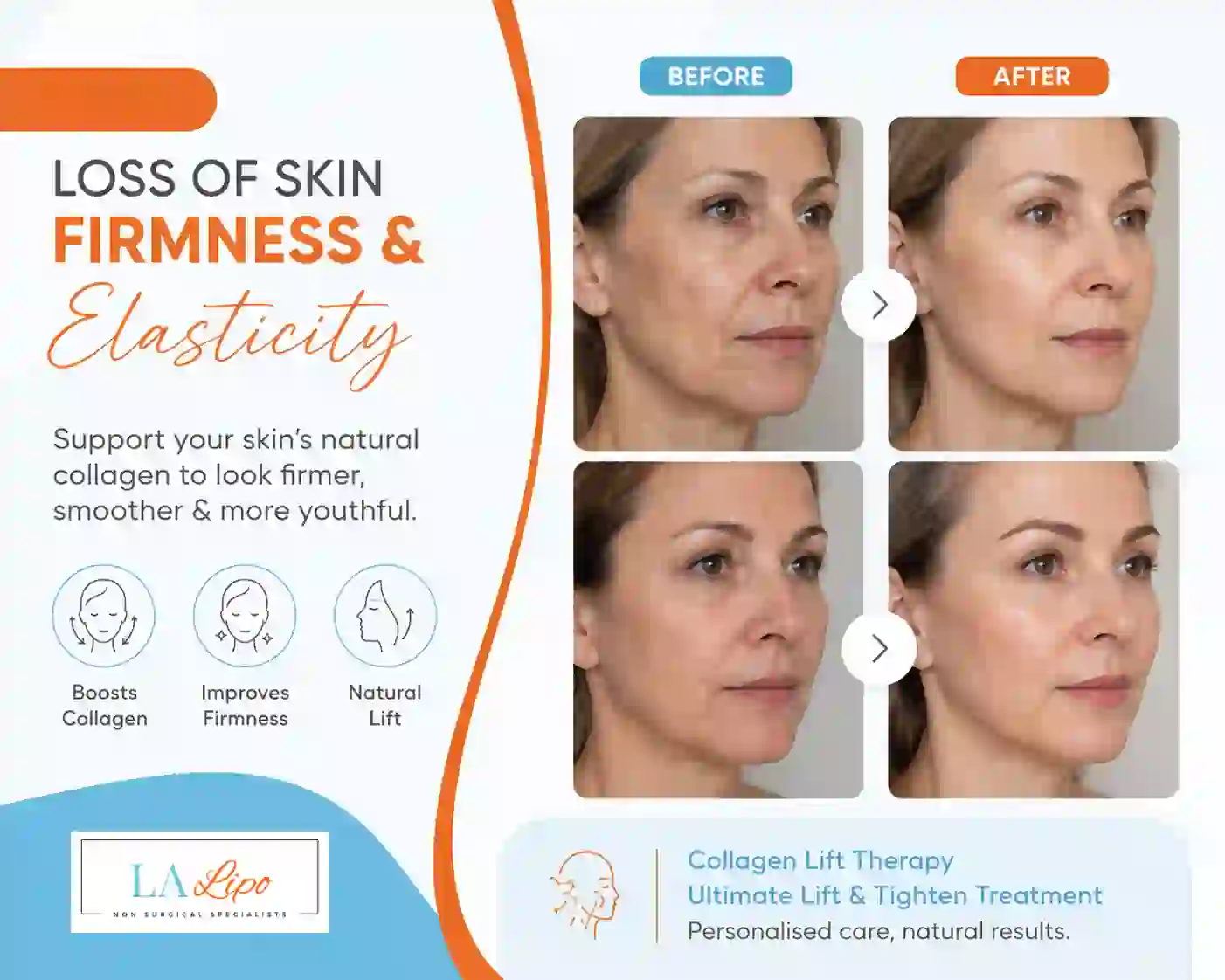 Sign #7: Loss of Skin Firmness and Elasticity Hertford